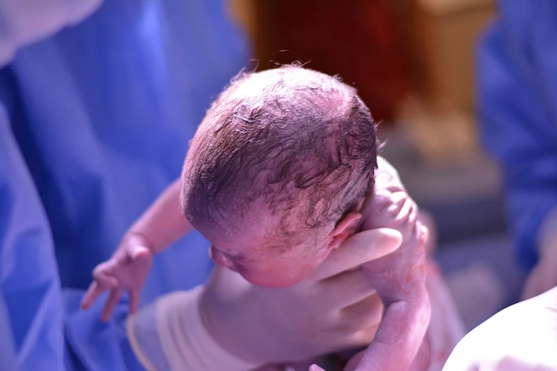 Empower your birth journey by understanding how a C-section can be a positive and prepared path to meeting your baby.